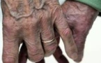 Maladie d'Alzheimer : pour les proches, un quotidien transformé en "enfer"