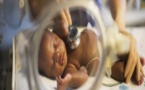 Sénégal: 5.000 enfants prématurés perdent la vie chaque année (Pédiatre)