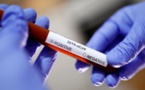 Point #Covid_19 de ce lundi 7 décembre: 2 décès, 76 nouvelles infections et 11 cas graves