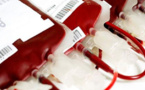 Gap de 65 000 poches de sang: le Directeur du Cnts liste ses stratégies pour renflouer les stocks