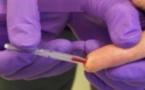 Lutte contre le sida: une nouvelle étude confirme l’efficacité de la circoncision