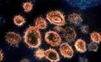 Covid-19: Le monde en alerte face au nouveau variant venu d'Afrique du Sud