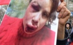 Une journaliste ukrainienne brutalement agressée