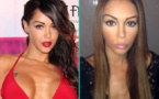 Nabilla : fini les prothèses ?
