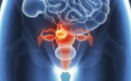 Cancer du col de l’utérus : plus de 11.317 cas sont enregistrés au Sénégal chaque année