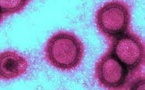 Ukraine: l'OMS recommande à Kiev de détruire les agents pathogènes utilisés dans ses laboratoires