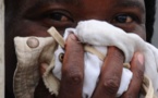 Guinée : une mystérieuse épidémie tue 25 personnes