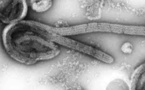 Côte d’Ivoire: les autorités sanitaires appellent à la vigilance face au virus Marburg