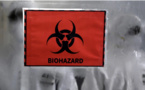 Mort en Inde d'un homme contaminé par la variole du singe