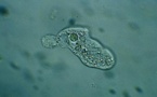 L'amoeba, l'organisme mangeur de cerveaux qui inquiète les Etats-Unis
