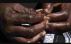 Excision : la pratique existe toujours en cachette au Sénégal (ONG)