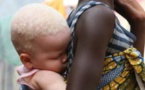 UN HOMME ARRÊTÉ POUR AVOIR TENTÉ DE VENDRE SA PETITE AMIE ALBINOS