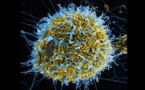 Attention : les « guéris » d’Ebola sont-ils réellement guéris ?