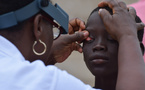 Santé : le Sénégal a éliminé le trachome
