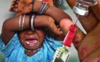  ​Rougeole à Kédougou: 4 cas déjà enregistrés, un enfant décédé