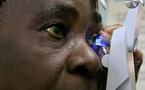 Santé oculaire : près de 165.000 aveugles et plus de 550.000 malvoyants recensés au Sénégal