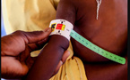 Malnutrition infantile : le Sénégal face au défi persistant du retard de croissance