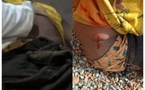 Saraya: cinq blessés et un suspect arrêté près de la frontière malienne, après un braquage déjoué