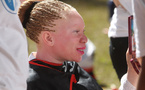À Madagascar, une série d’attaques contre des personnes albinos ravive la peur