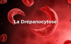 Drépanocytose à Kolda : plus de 250 enfants suivis et un traitement à vie inaccessible pour les familles