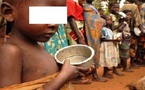 Malnutrition : 75 % des enfants sénégalais n’atteignent pas la diversité alimentaire minimale