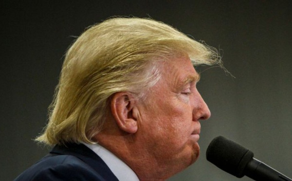 Le médecin de Donald Trump révèle le secret de sa chevelure