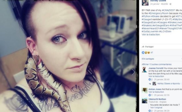 Etats-Unis : elle termine aux urgences à cause d'un serpent coincé dans son oreille