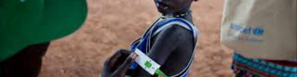 Santé-5 signes que votre enfant souffre d'une intolérance alimentaire
