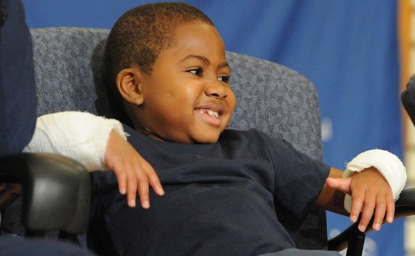 USA: première greffe des deux mains chez un enfant
