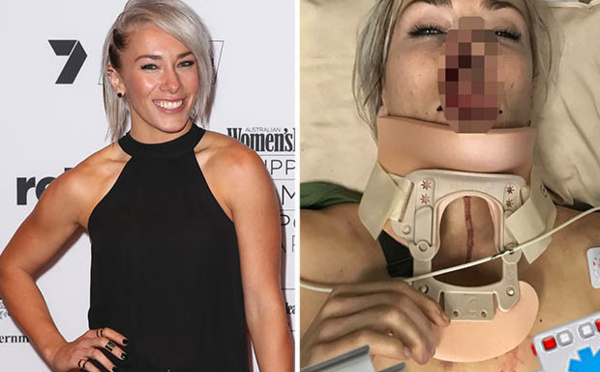 La championne du monde de BMX Caroline Buchanan fait un grave accident