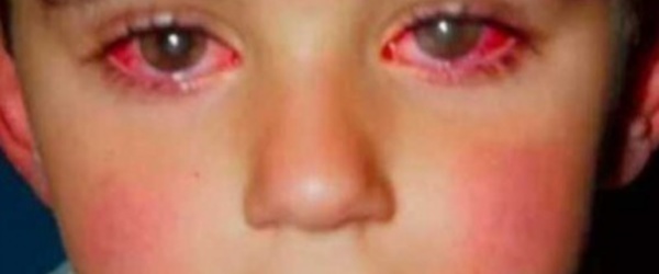 Cet enfant a perdu 75% de sa vue à cause d’un jouet que vous avez certainement à la maison