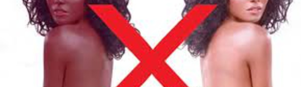 Rwanda : le Président Paul Kagamé poursuit sa campagne de répression contre la dépigmentation