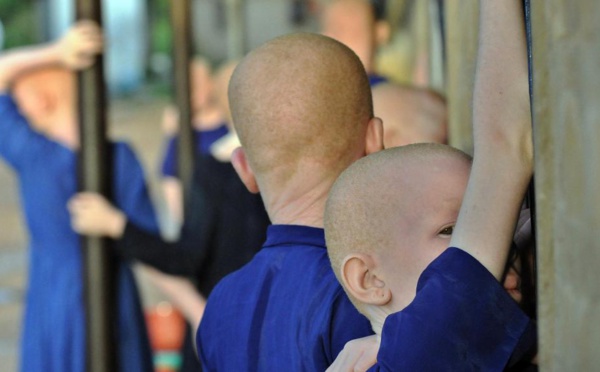 Burundi: le corps d’un jeune albinos retrouvé démembré