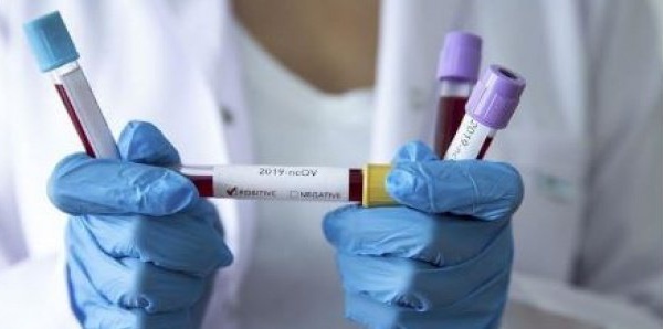 Vaccin COVID-19 Chine-Russie : les essais cliniques devront prendre fin d’ici fin septembre