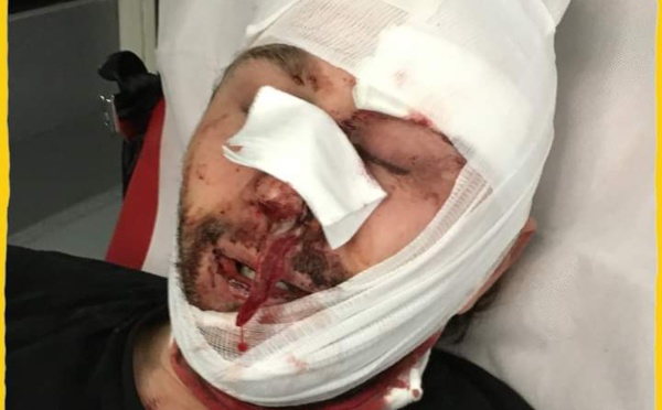 Marche des Libertés: les policiers français fracassent le visage d’un photojournaliste syrien