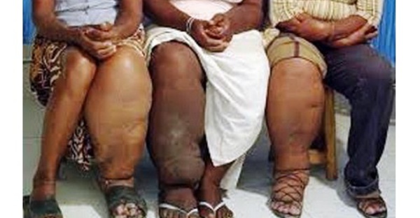 Maladies tropicales négligées: l'OMS publie un nouveau plan décennal