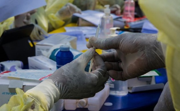 Guinée: premier cas du virulent virus de Marburg, le premier en Afrique de l'Ouest (OMS)