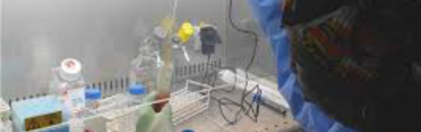 Tout ce qu'il faut savoir sur la maladie à virus de Marburg