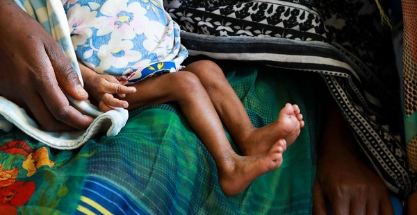 Éthiopie : une grave crise de la faim touche les régions d’Amhara, Afar et Tigré