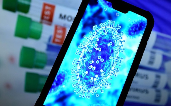 Espagne: deuxième décès d'un patient contaminé par la variole du singe