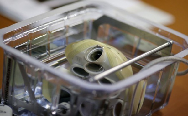 Santé: Un deuxième cœur artificiel implanté à Nantes