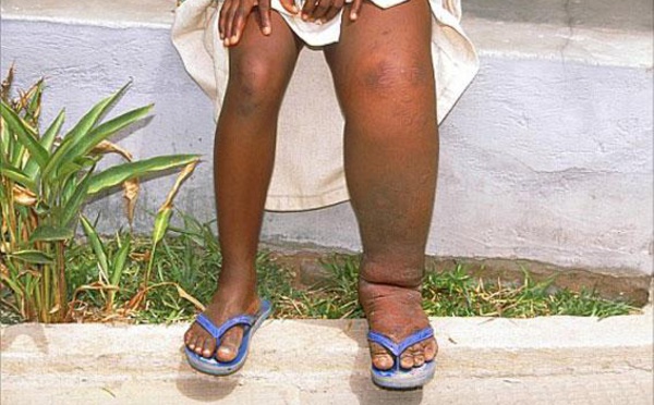 Elimination des MTN en Afrique : lancement d'une nouvelle initiative visant à mobiliser les jeunes