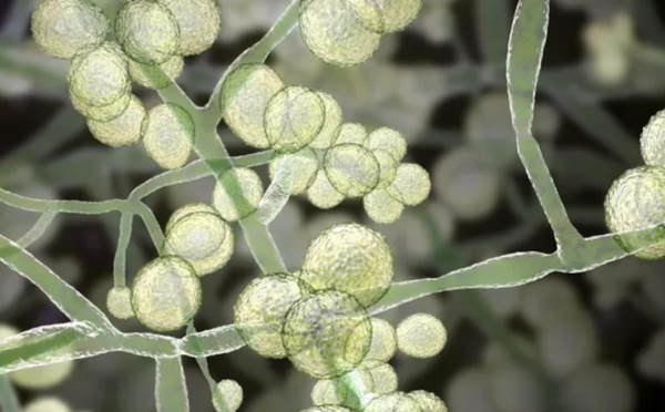 La propagation rapide d’un champignon potentiellement mortel inquiète les États-Unis