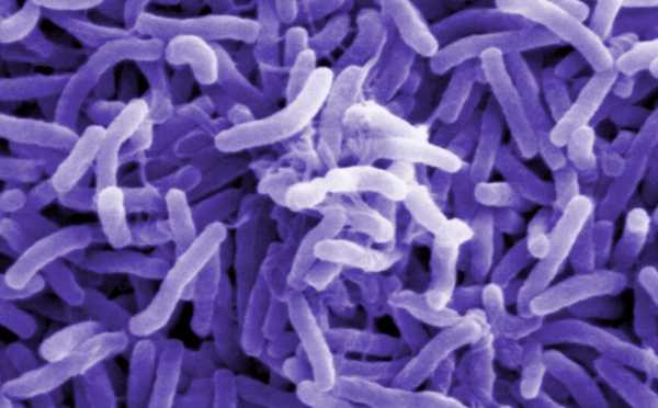 Au Cameroun, cinq régions sont désormais touchées par une épidémie de choléra