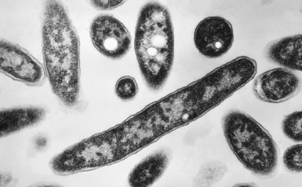 La Pologne victime d’une épidémie de légionellose: 11 morts, 144 contaminés