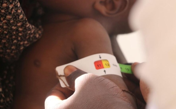 Mali: la malnutrition infantile est à son plus haut depuis 10 ans, s’alarme Action contre la faim