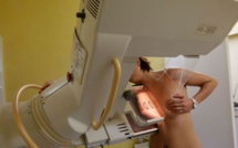 ​Docétaxel et cancer du sein: «La baisse de globules blancs a dégénéré»