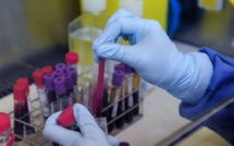 ​Sida: des chercheurs français font une avancée majeure