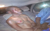 ​Touba : un homme échappe à la mort après un lynchage