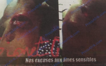 ​Charcutée par sa coépouse, la victime raconte l’horreur